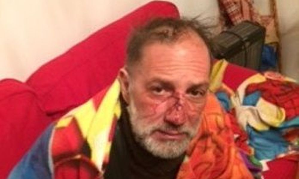Ξανά στο στόχαστρο οι φωτορεπόρτερ