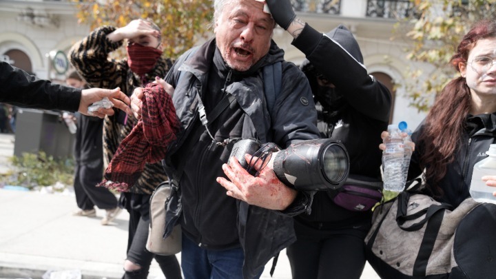 “Αφωνία” από ΠΟΕΣΥ, ΕΣΗΕΑ, ΕΦΕ για τον τραυματισμό του φωτορεπόρτερ του ΑΠE